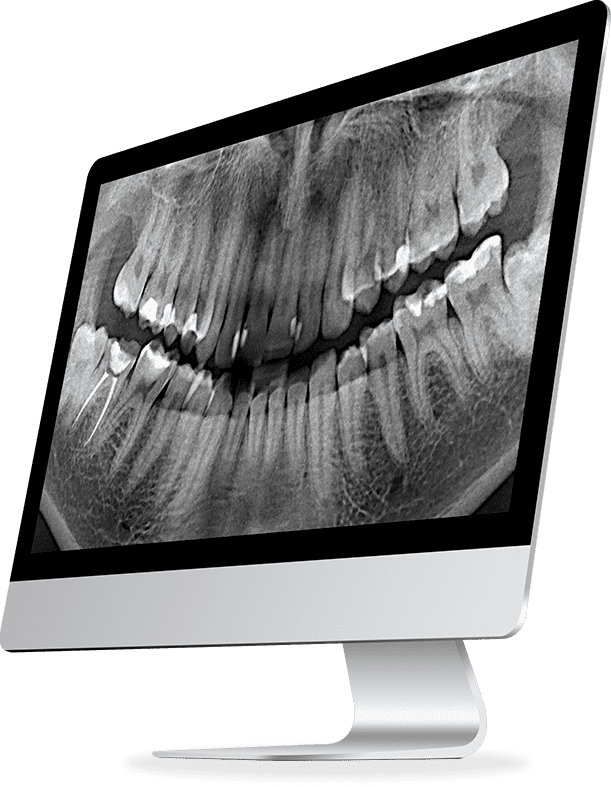 расшифровка стоматологических снимков diagnocat