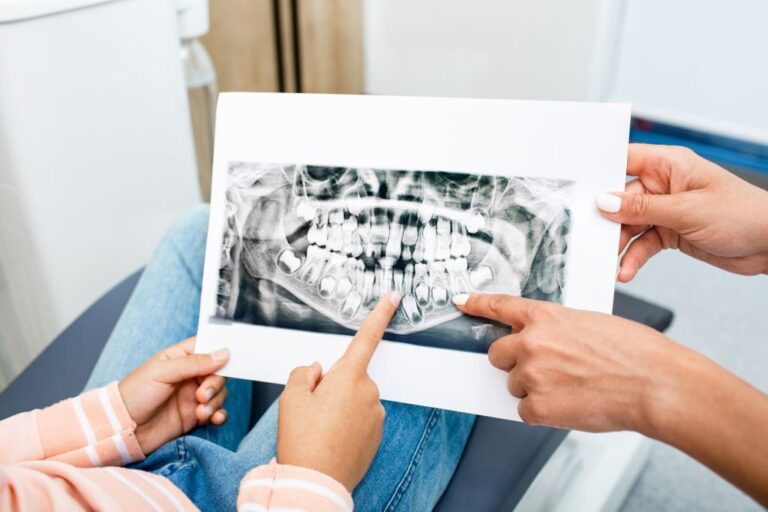 рентген молочных зубов владивосток
